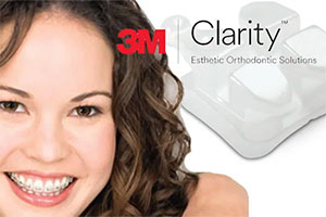 3M Clarity Aligners