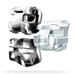 Damon brackets for braces
